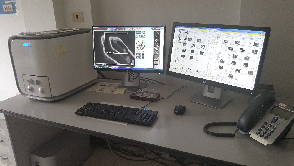 SEM-Microscopio Elettronico a Scansione e su componenti