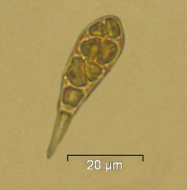 Alternaris sp., spora fungina