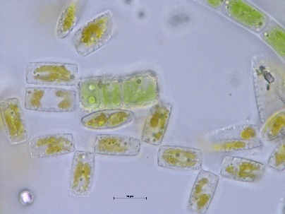 Diatomee (tra cui Epithemia turgida) ed alghe filamentose: ingrandimento 400X