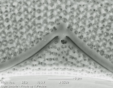 Epithemia tugida: ingrandimento 5500 X